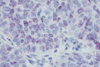 PD-L1 RISH, Lung cancer, TME
