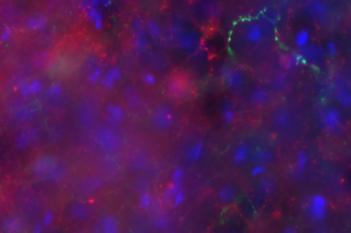 mCherry+GFP, Axon Density