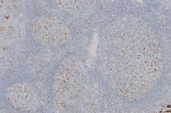 PD-L1, Germinal Center Detection, AI