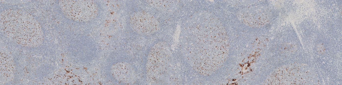 PD-L1, Germinal Center Detection, AI