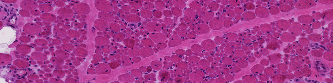 H&E, Centronuclear Myopathy