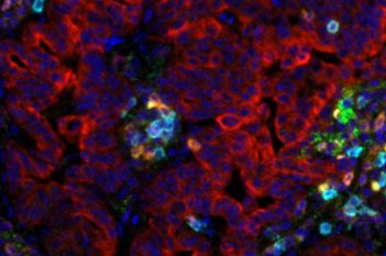 Multiplex, Lung Cancer, TME (Akoya Biosciences, Inc.)