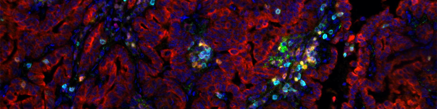 Multiplex, Lung Cancer, TME (Akoya Biosciences, Inc.)