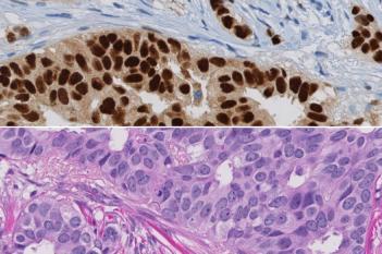 Nuclei Detection, AI (Brightfield)