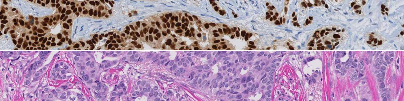 Nuclei Detection, AI (Brightfield)