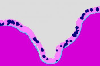 Rodent, Pulmonary MCM, AB-PAS