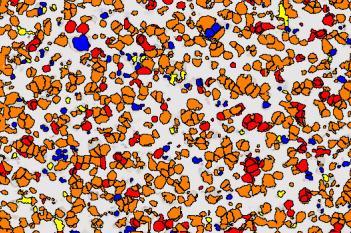 PD-L1, Cell Lines, Cancer