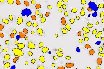 ER, Cell Lines, Cancer