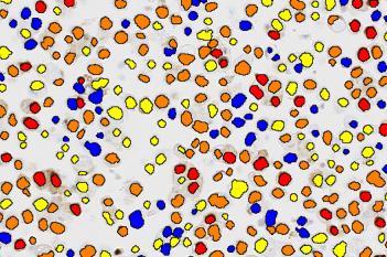 PR, Cell Lines, Cancer