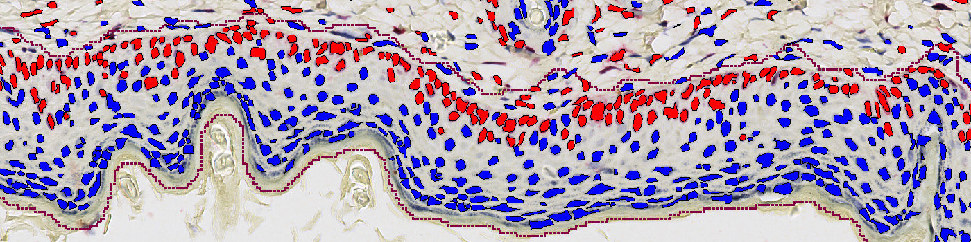Ki-67, Epidermal Hyperplasia