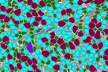 Iron Hematoxylin, Adipose Tissue