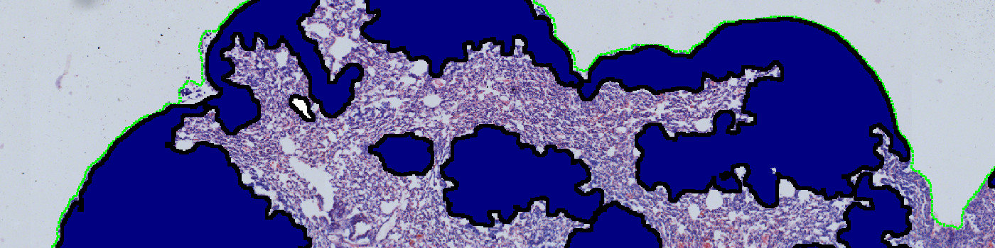 H&E, Lung Metastasis
