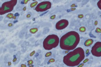 Toluidine Blue, Neuroscience