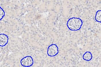 IHC, Glomeruli Detection, AI