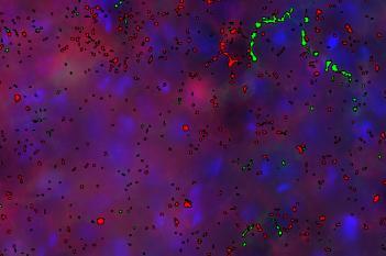 mCherry+GFP, Axon Density