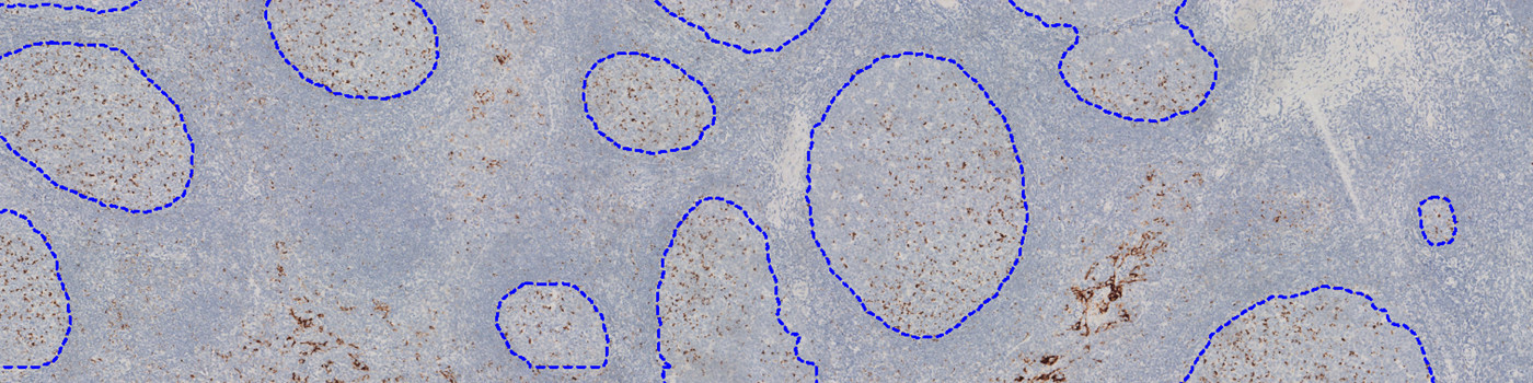 PD-L1, Germinal Center Detection, AI