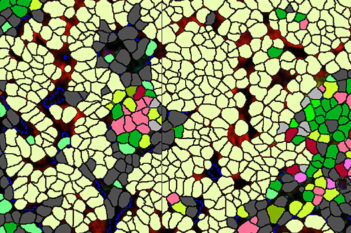 Multiplex, Lung Cancer, TME (Akoya Biosciences, Inc.)