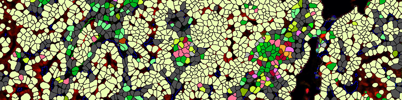 Multiplex, Lung Cancer, TME (Akoya Biosciences, Inc.)