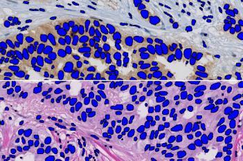 Nuclei Detection, AI (Brightfield)