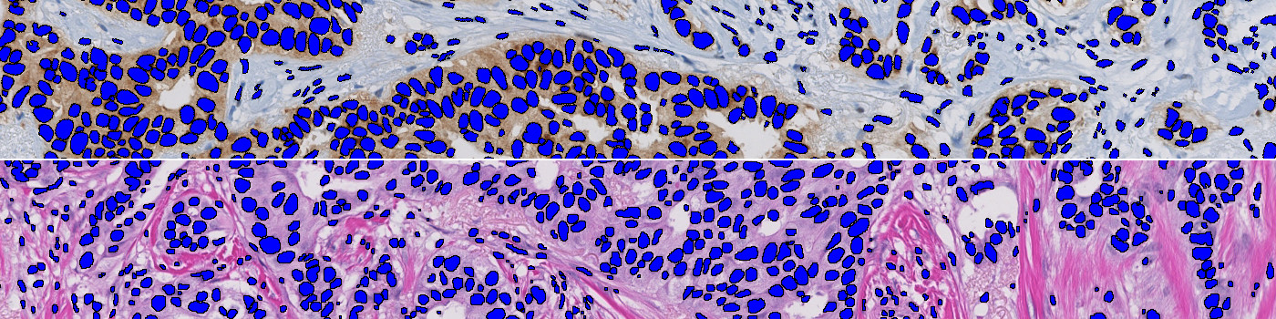 Nuclei Detection, AI (Brightfield)