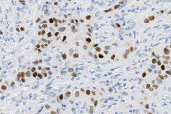 IHC, Nuclei Detection, AI