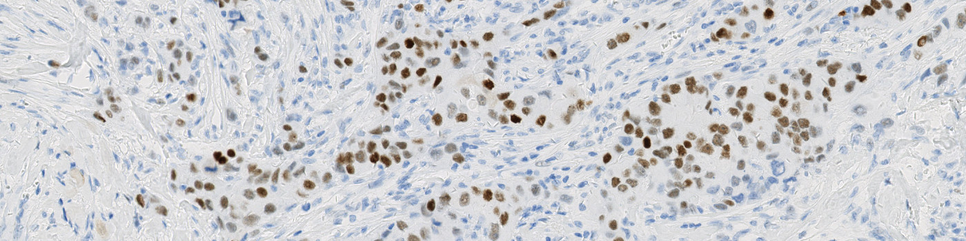 IHC, Nuclei Detection, AI