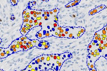 IHC, Nuclei Detection, AI