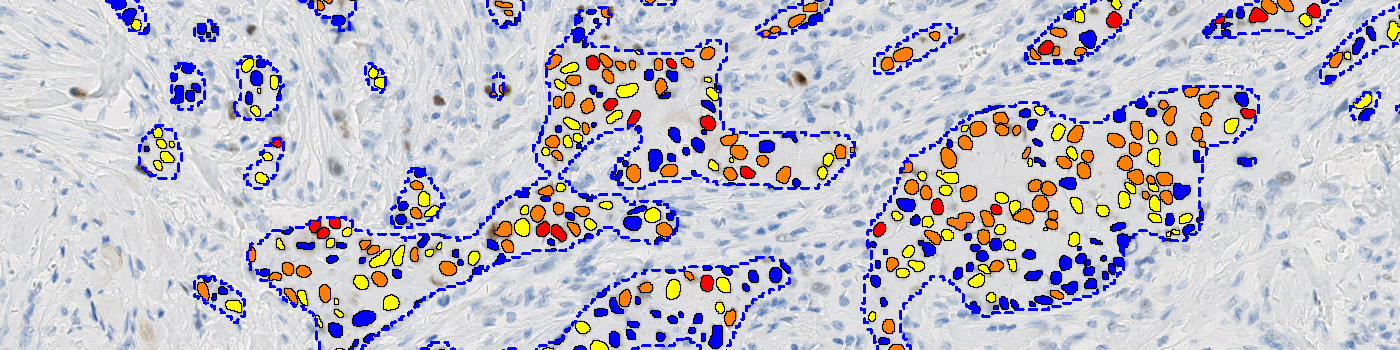IHC, Nuclei Detection, AI