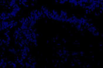 Nuclear Detection, AI (Fluorescence)