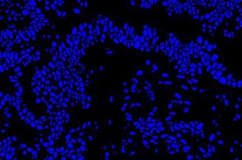 Nuclear Detection, AI (Fluorescence)