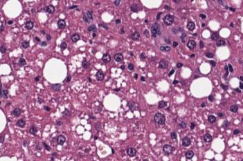 H&E, NAS, AI (Rodent)