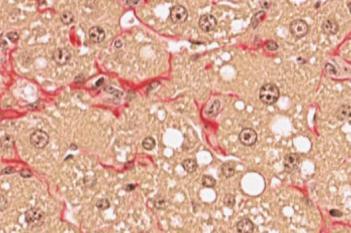 PSR, Liver Fibrosis, AI (Rodent)