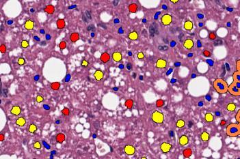 H&E, NAS, AI (Rodent)