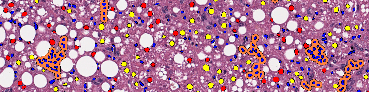 H&E, NAS, AI (Rodent)