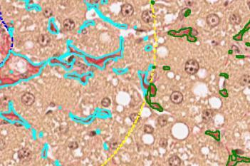 PSR, Liver Fibrosis, AI (Rodent)