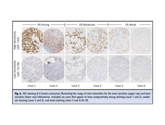 Range of stain intensity