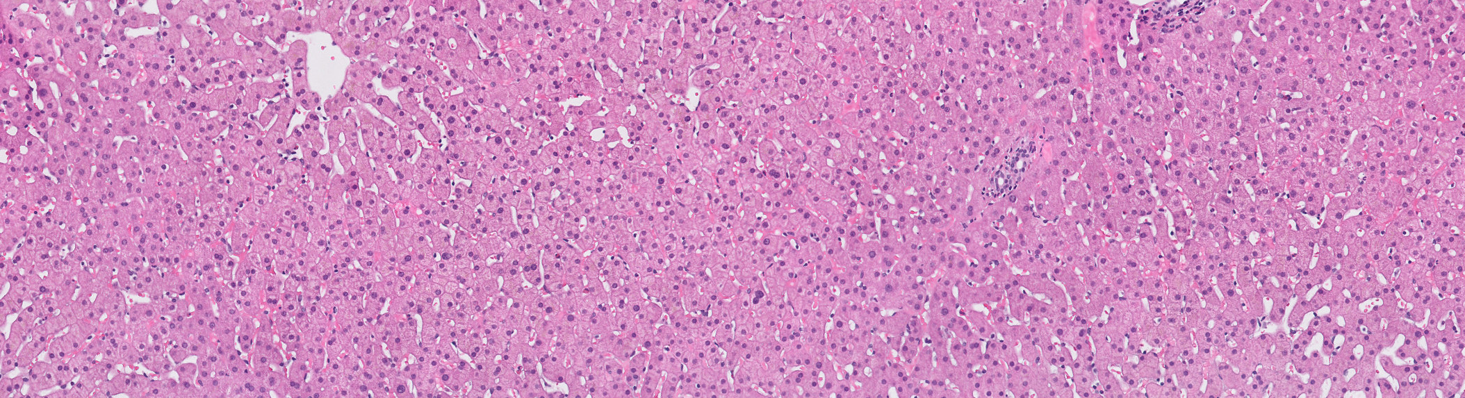 Visiopharm liver tissue research